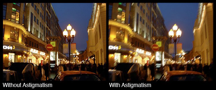 Astigmatism